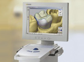 Cerec Dental Restorations in Peabody, MA