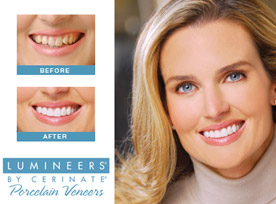 Lumineers and Porcelain Veneers in Peabody, MA